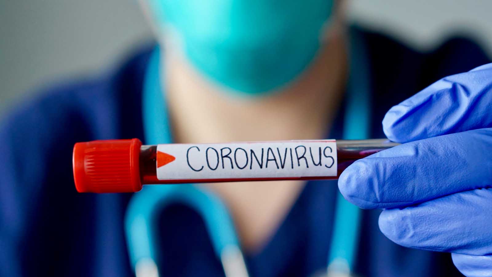 Les leçons du coronavirus